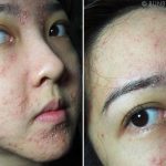 Kesalahan Memakai Skincare Yang Bisa Merusak Kulit