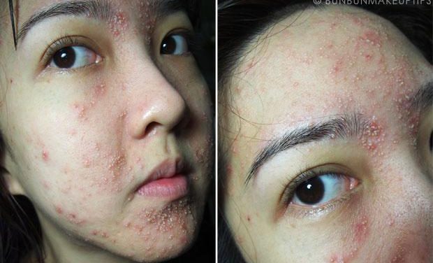 Kesalahan Memakai Skincare Yang Bisa Merusak Kulit