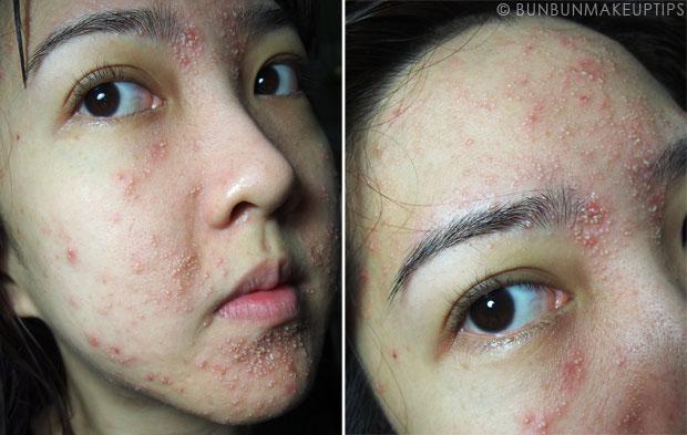 Kesalahan Memakai Skincare Yang Bisa Merusak Kulit