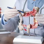 Kesehatan Pencernaan: Makan Yang Mendukung Fungsi Usus
