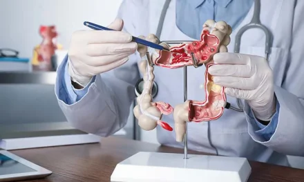 Kesehatan Pencernaan: Makan Yang Mendukung Fungsi Usus