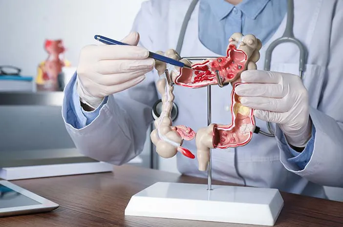 Kesehatan Pencernaan: Makan Yang Mendukung Fungsi Usus