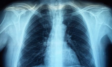 Rontgen: Prosedur Pemeriksaan Dan Manfaatnya Diagnosis Medis