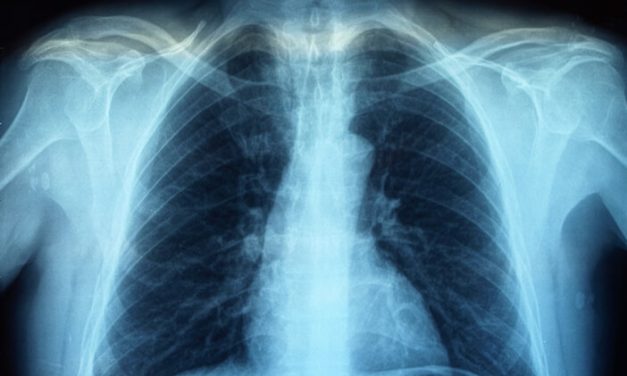 Rontgen: Prosedur Pemeriksaan Dan Manfaatnya Diagnosis Medis